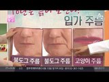 10년은 늙어 보인다? 입가주름의 이모저모!
