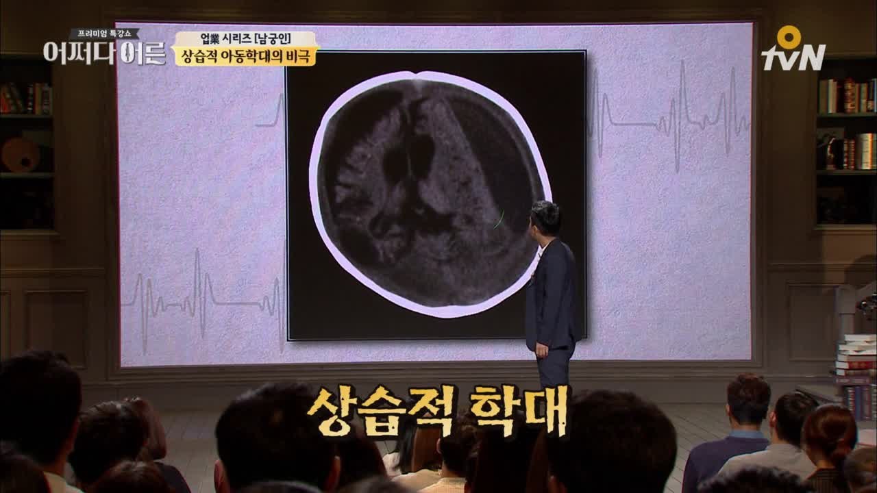 상습적 아동학대의 끔찍한 현실