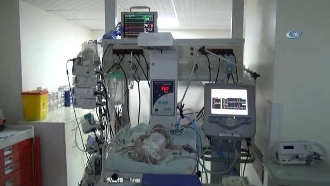 Kalbinin Yarısı Çalışmayan Suriyeli Bebek Ameliyat Oldu