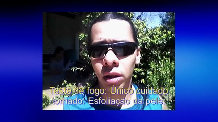 Bronzeamento sem manchas. sem alaranjado, em 10 minutos! SEM CONTRAINDICAÇÃO.