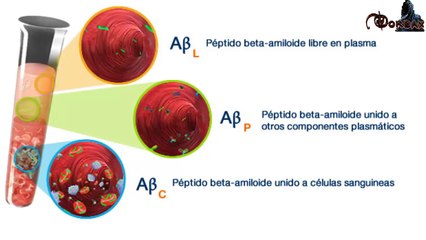 CUIDADO!!! EL ALZHEIMER PUEDE PROPAGARSE A TRAVÉS DE TRANSFUSIONES DE SANGRE