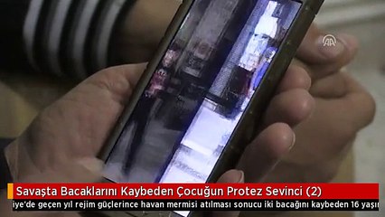 Savaşta Bacaklarını Kaybeden Çocuğun Protez Sevinci (2)