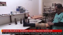 Savaşta Bacaklarını Kaybeden Çocuğun Protez Sevinci (1)