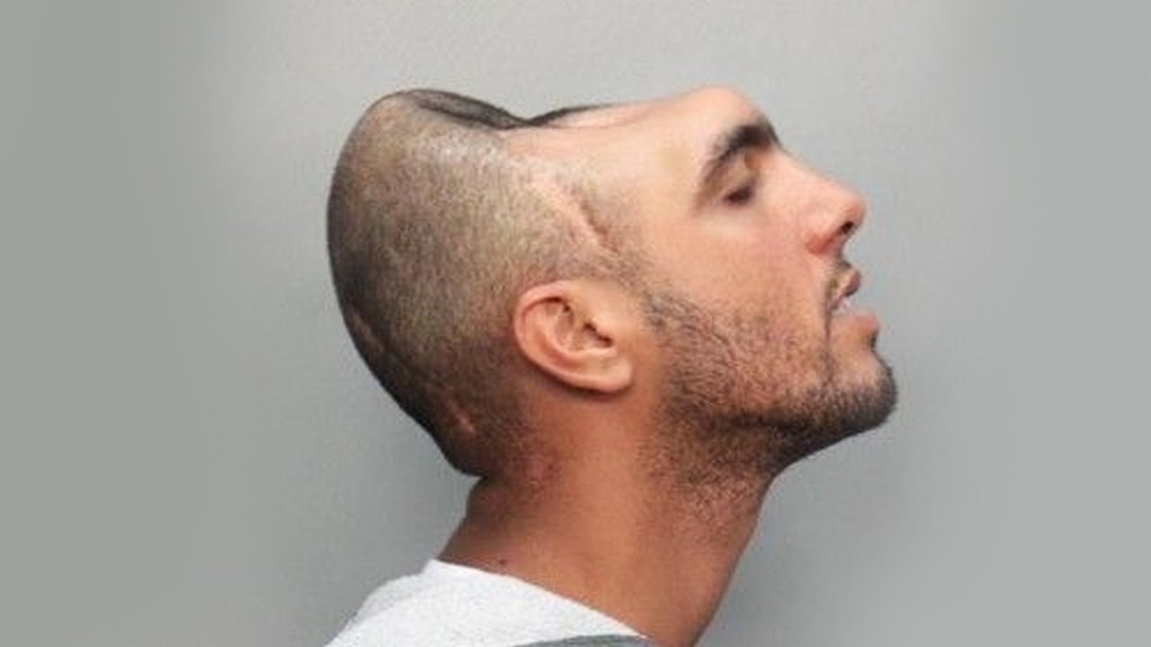 Top 10 People Who Survived The Impossible