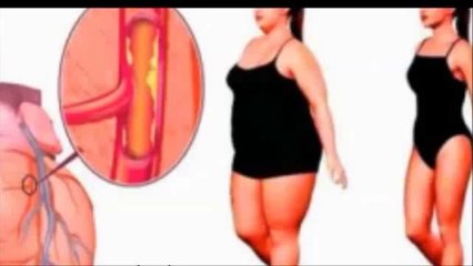 Esta bebida destapa tus arterias y te protege contra las enfermedades del corazón