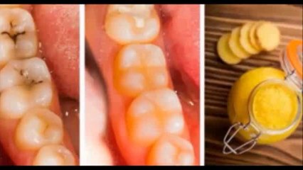 SE TU PROPIO DENTISTA! CURA LAS CARIES CON ESTA PASTA DENTAL DE GRAN ALCANC]