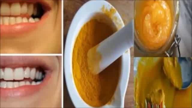 ¿Cómo blanquear los dientes de manera natural con la cúrcuma