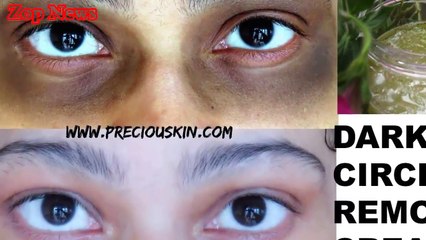 6 Tips to get Rid from Dark Circles in 1 Day in Hindi