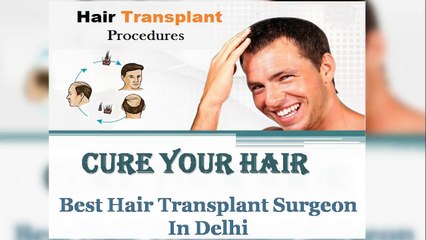 Best Hair Transplant Surgeon In Delhi