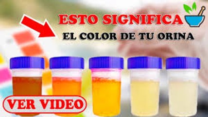 El Color De la Orina Dice Todo Sobre TU Salud ¡ESTO Es Lo Que Significa Su Color y Que Podría Andar