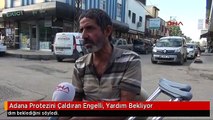 Adana Protezini Çaldıran Engelli, Yardım Bekliyor