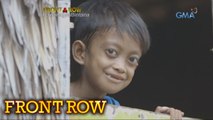 Front Row: Batang may severe malnutrition noon, dinagsa ng tulong