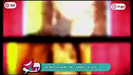 Antes y después de las famosas
