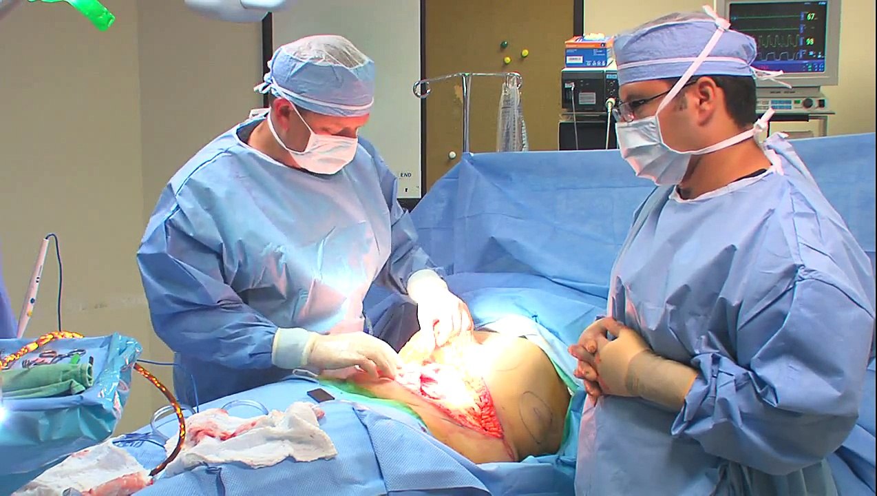 Miami Plastic Surgery - Tummy Tuck (Abdominoplasty) Surgery with Dr. Michael Kelly