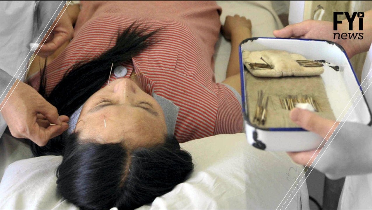 Acubots: The Acupuncture Robot