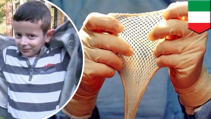 Boy with rare condition gets new skin with gene therapy