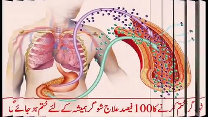 Shugar Ka Ilaj - Share please