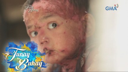 Tunay na Buhay: Pitong taong gulang na bata, lumalaban sa “Butterfly disease”