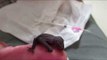 Baby Microbat Is Cared for by His Rescuer