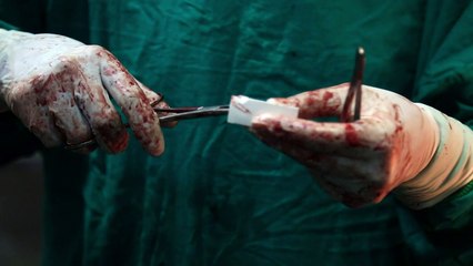 اجراءات طبية "غير مرغوب فيها" في الغوطة المحاصرة