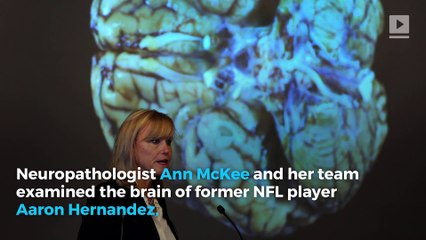 Aaron Hernandez's CTE was more severe than expected