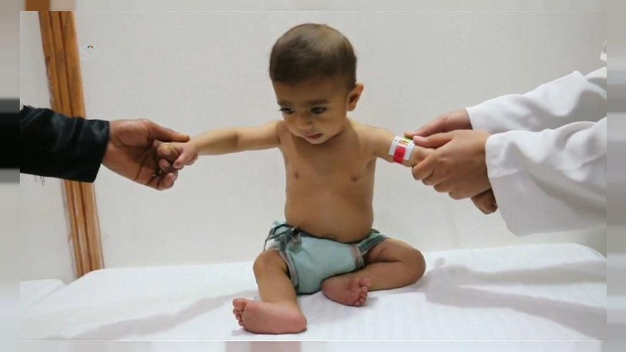 Syrien: UN warnen vor weiterer humanitärer Katastrophe