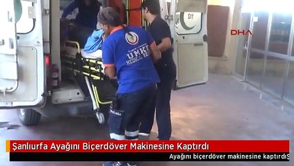 Şanlıurfa Ayağını Biçerdöver Makinesine Kaptırdı