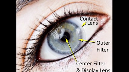 Contact lenses Hunters Hill