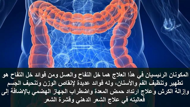 علاج مشكلة الامساك وتنظيف القولون وازالة السموم فى آنِ واحد بهذه الوصفة المنزلية المذهلة !!