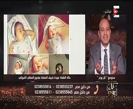 بعد نشر قصتها باليوم السابع..عمرو أديب: تركى الشيخ تبرع بمليون جنيه لعلاج الطفلة فريدة