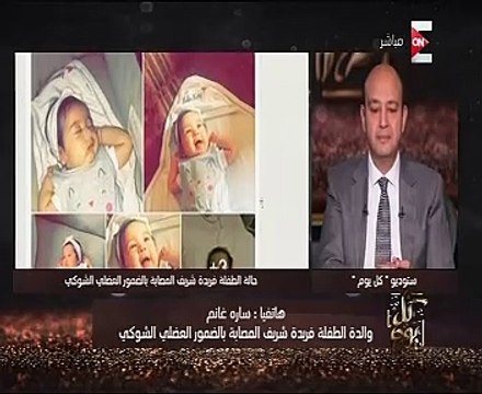 بعد نشر قصتها باليوم السابع..عمرو أديب: تركى الشيخ تبرع بمليون جنيه لعلاج الطفلة فريدة
