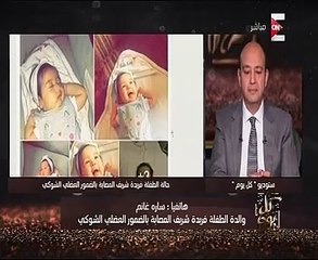 بعد نشر قصتها باليوم السابع..عمرو أديب: تركى الشيخ تبرع بمليون جنيه لعلاج الطفلة فريدة