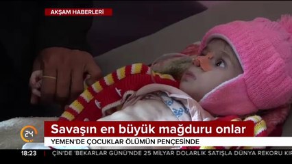Savaşın en büyük mağduru çocuklar