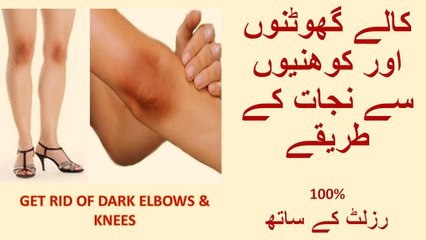 Lighten Dark Knees and Elbows FAST - Get Rid Of Dark Elbows & Knees