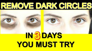 Remove Dark Circles Permanently - Remove Dark Circles in 3 Days - You Must Try