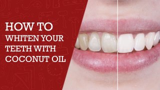 Teeth Whitening Naturally - How to Whiten Your Teeth With Coconut Oil
