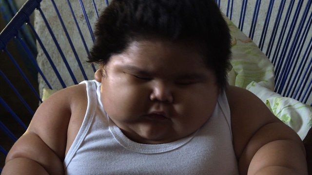 Mexique: Luisito, un bébé de 28 kg en attente d'un diagnostic