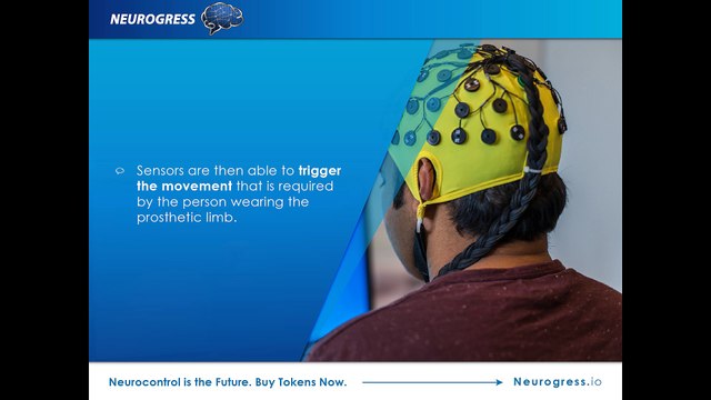 Operation? No, thanks! Neuro-controlled prosthetic limbs