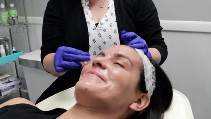 Microneedling Skin Rejuvenation - Is It Really Helpful?