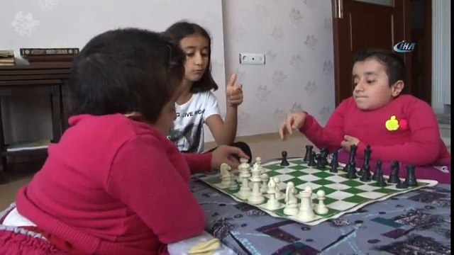 Cam Kemik Hastası İkizlerden Birinin Kemiği Kırılınca Diğeri de Hissediyor