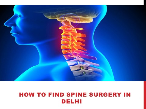 How to Find Spine Surgery in Delhi with Spine and Brain India