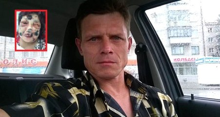 Rusya'nın Hannibal'ı! İnternetten Tanıştı, Tüm Vücudunu Isırarak Ağır Yaraladı