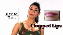 How to get rid of Chapped Lips