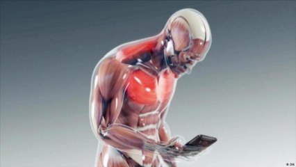 As doenças que deixam as costas curvadas