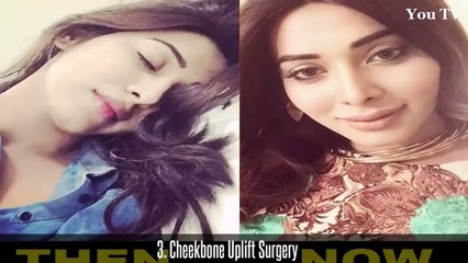 Actress Eshal Fayyaz Face Transformation Before & After Plastic Surgery