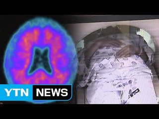 MRI 촬영으로 치매 진단...내년 상용화 / YTN