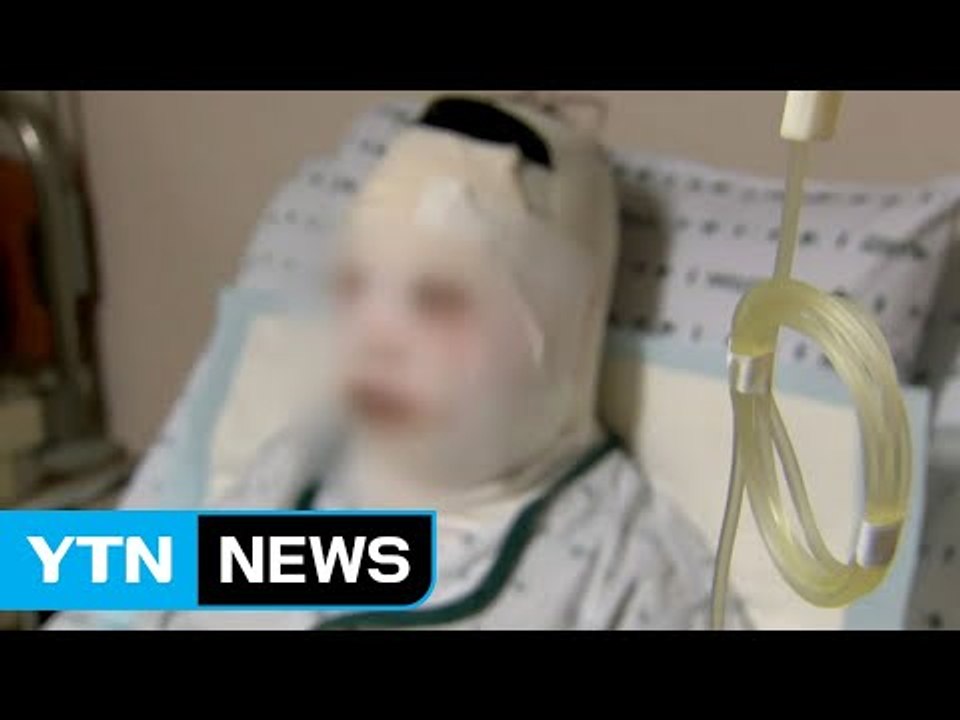 라면 봉변 피해자는 '예비 신부'...끔찍한 폭행의 전말 / YTN