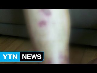 경찰, '전공의 폭행' 부산대병원 교수 수사 / YTN