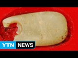 서울 암사동 신석기시대 유적지에서 옥 장신구 출토 / YTN (Yes! Top News)