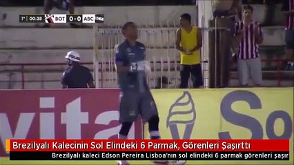 Brezilyalı Kalecinin Sol Elindeki 6 Parmak, Görenleri Şaşırttı